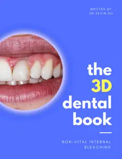 3d dental book: non-vital internal bleaching book cover image