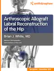 Arthroscopic Allograft Labral Reconstruction synopsis, comments