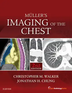 muller's imaging of the chest e-book imagen de la portada del libro