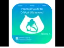 Practical Guide to Critical Ultrasound e-book
