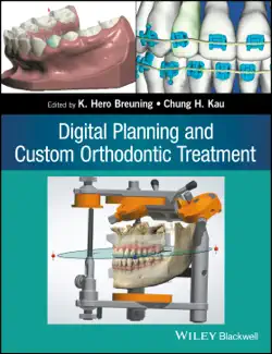 digital planning and custom orthodontic treatment book cover image