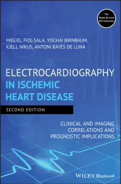 electrocardiography in ischemic heart disease imagen de la portada del libro