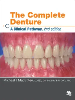the complete denture book cover image