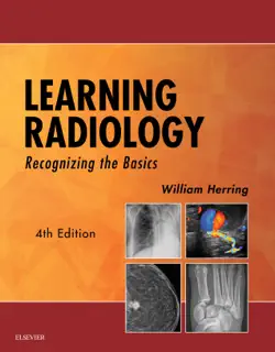 learning radiology book cover image