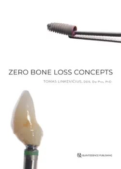 zero bone loss concepts book cover image