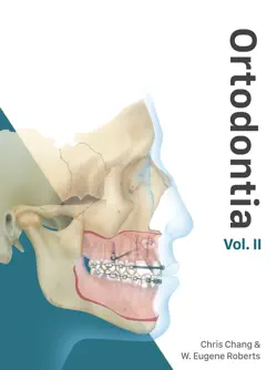 ortodontia vol. ii book cover image