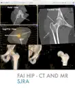 FAI Hip CT synopsis, comments