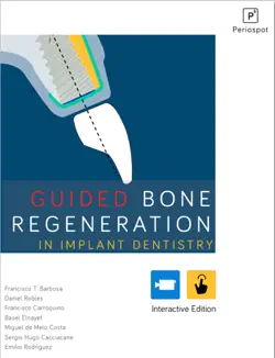 guided bone regeneration imagen de la portada del libro