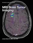 MRI Brain Tumor Imaging synopsis, comments