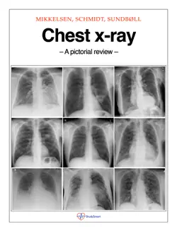 chest x-ray book cover image