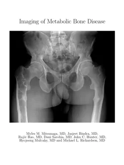imaging of metabolic bone disease book cover image