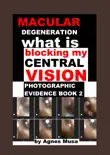 Macular Degeneration, What Is Blocking My Central Vision, Photographic Evidence Book 2 synopsis, comments