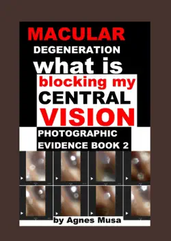 macular degeneration, what is blocking my central vision, photographic evidence book 2 book cover image