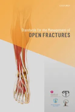 standards for the management of open fractures imagen de la portada del libro