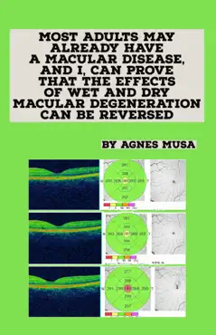 most adults may already have a macular disease, and i, can prove that the effects of wet and dry macular degeneration can be reversed book cover image