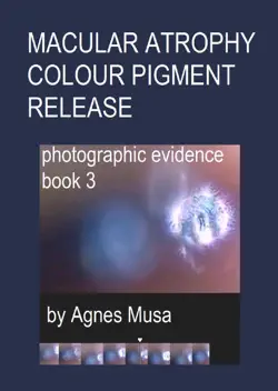 macular atrophy colour pigment release, photographic evidence book 3 book cover image