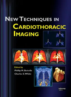 new techniques in cardiothoracic imaging imagen de la portada del libro