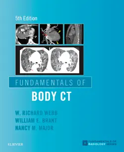 fundamentals of body ct e-book book cover image