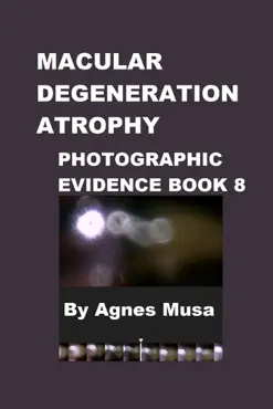 macular degeneration, photographic evidence book 8 book cover image