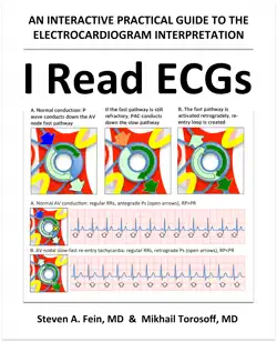 i read ecgs book cover image