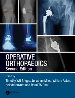 operative orthopaedics book cover image
