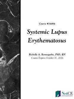 systemic lupus erythematosus book cover image
