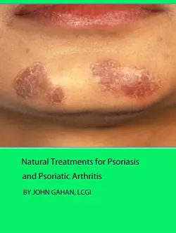 natural treatments for psoriasis and psoriatic arthritis book cover image