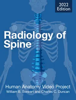 radiology of spine book cover image
