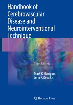 handbook of cerebrovascular disease and neurointerventional technique book cover image