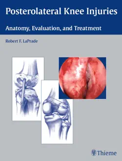 posterolateral knee injuries book cover image