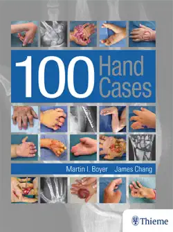 100 hand cases book cover image