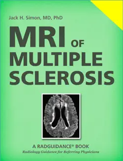 mri of multiple sclerosis book cover image