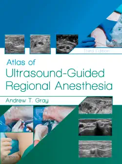 atlas of ultrasound-guided regional anesthesia e-book book cover image
