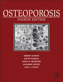 osteoporosis (enhanced edition) book cover image
