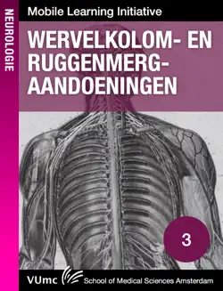 wervelkolom- en ruggenmerg-aandoeningen book cover image