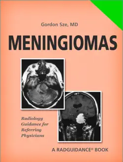 meningiomas book cover image