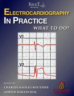 electrocardiography in practice: what to do? book cover image