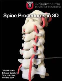 spine procedures in 3d imagen de la portada del libro