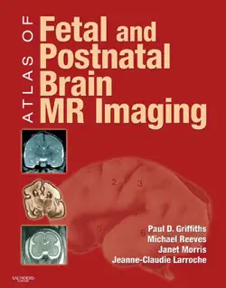atlas of fetal and postnatal brain mr imaging book cover image