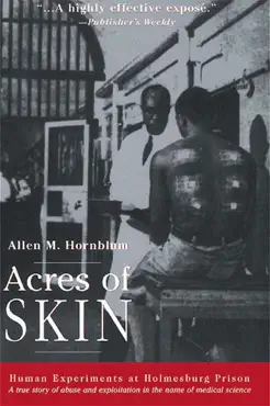 acres of skin book cover image