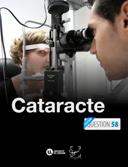 cataracte book cover image