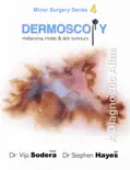 Dermoscopy: Melanoma, Moles and Skin Tumours book summary, reviews and download