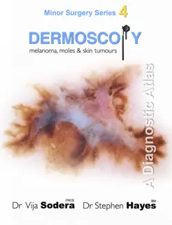 dermoscopy: melanoma, moles and skin tumours book cover image