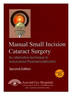 manual small incision cataract surgery book cover image