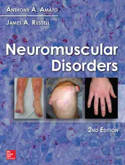 neuromuscular disorders, 2nd edition book cover image