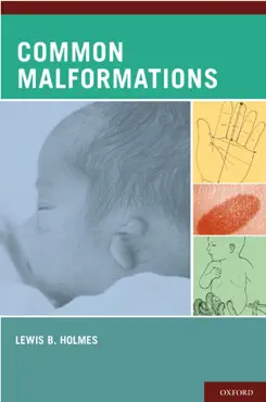 common malformations book cover image