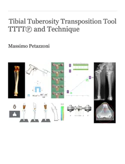 tttt - tibial tuberosity transposition tool and technique book cover image