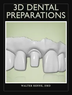 3d dental preparations book cover image