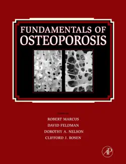 fundamentals of osteoporosis book cover image