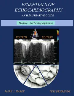essentials of echocardiography module aortic regurgitation book cover image
